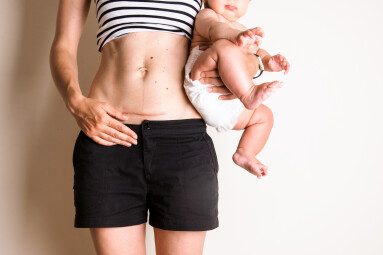 C,Section,Cesarean,Operation,Heal,After,Mother,Holding,Baby,Postpartum