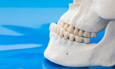 Model,Of,Prognathism.,Jawbones,With,Maxillary,And,Mandibular,Dentition,And