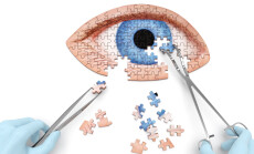 Eye,Operation,(vision,Correction),Puzzle,Concept:,Hands,Of,Surgeon,With