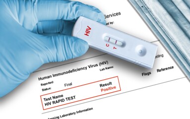 Hiv,Positive,Antigen,Test,Result,By,Using,Rapid,Self,Testing