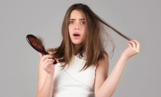 Hair,Loss,Woman,With,A,Comb,And,Problem,Hair.,Hairloss