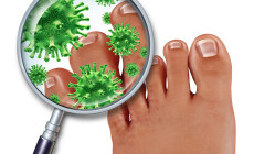 Foot,Fungus,Disease,With,A,Close,Up,Of,The,Human
