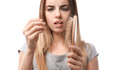 Woman,With,Hair,Loss,Problem,On,White,Background