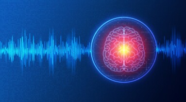 Neuromodulation,And,Neurostimulation,-,Alteration,Of,Nerve,Activity,Through,Targeted