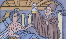 Syphilis,In,Europe,A,Woman,In,Bed,And,A,Man
