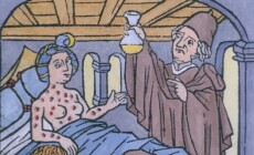 Syphilis,In,Europe,A,Woman,In,Bed,And,A,Man
