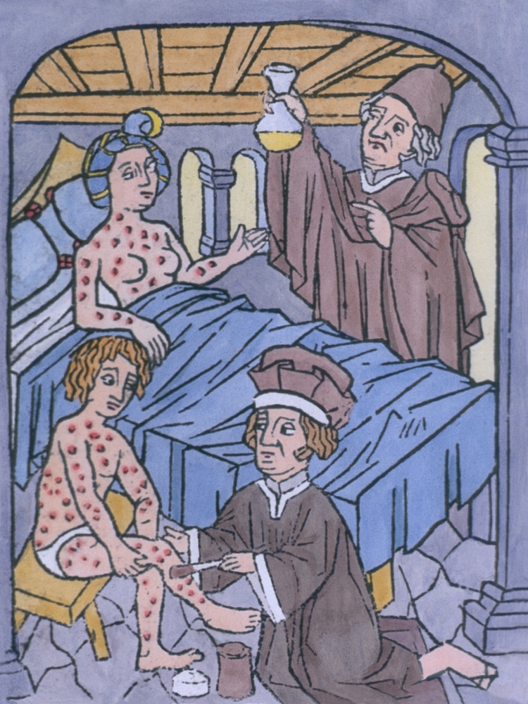 Syphilis,In,Europe,A,Woman,In,Bed,And,A,Man