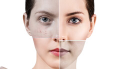 Square,Parts,Shows,Skin,After,Treatment.