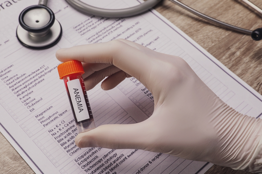 Doctor,Holding,Test,Tube,With,Blood,Sample,And,Label,Anemia
