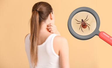 Young,Woman,Scratching,Her,Skin,And,Tick,Visible,Through,Magnifying