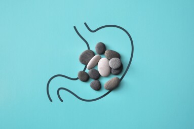 Stones,On,The,Silhouette,Of,The,Stomach.,A,Symbol,Of