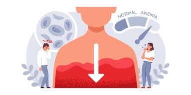 Iron,Deficiency,Anemia,Symptoms.,Characters,Experience,Symptoms,Of,Iron,Deficiency: