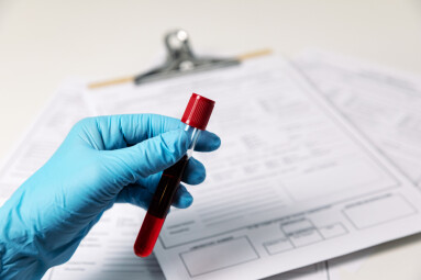 Test,Tubes,With,Blood.,Ncov,,Coronavirus,Test