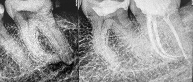neodenta_1 1 (1)
