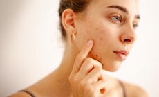 A,Woman,Touches,Her,Face,Gently,While,Inspecting,Her,Skin