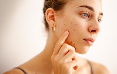 A,Woman,Touches,Her,Face,Gently,While,Inspecting,Her,Skin