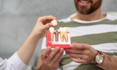 Doctor,Showing,Patient,Educational,Model,Of,Dental,Implant,In,Clinic,
