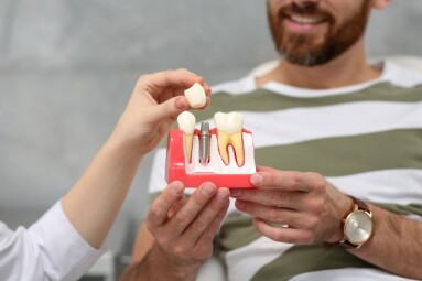 Doctor,Showing,Patient,Educational,Model,Of,Dental,Implant,In,Clinic,