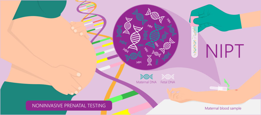 Noninvasive,Prenatal,Testing,Nipt,Screening,Genetic,Disorders,Bloodstream,Cfdna,Lab