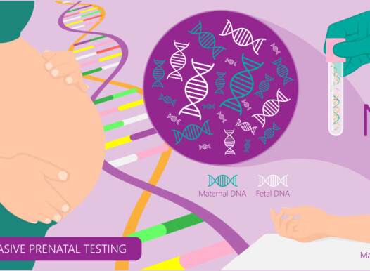 Noninvasive,Prenatal,Testing,Nipt,Screening,Genetic,Disorders,Bloodstream,Cfdna,Lab